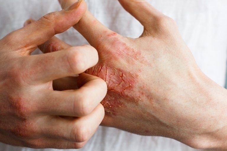 cách diệt kiến ba khoang